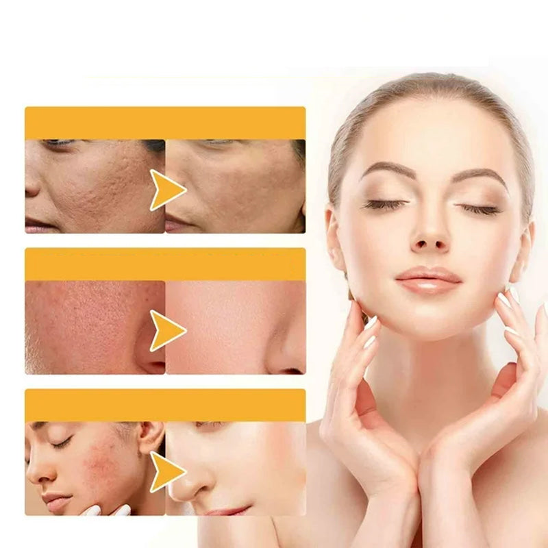 Gold Foil Peel-off Mask